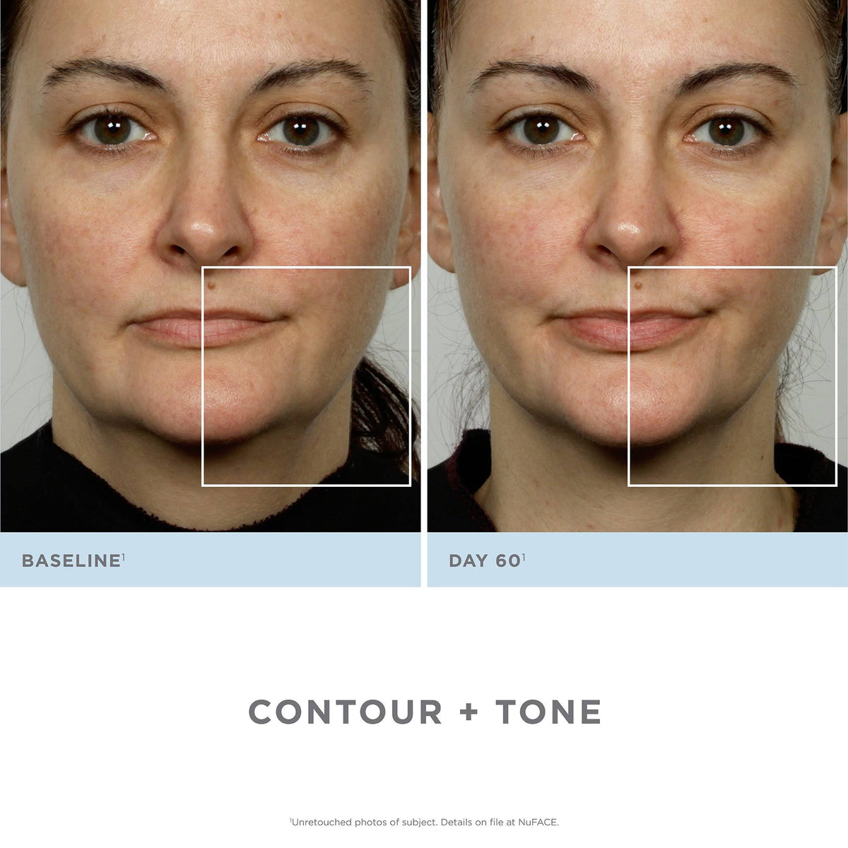 Facial Toning Kit G62088