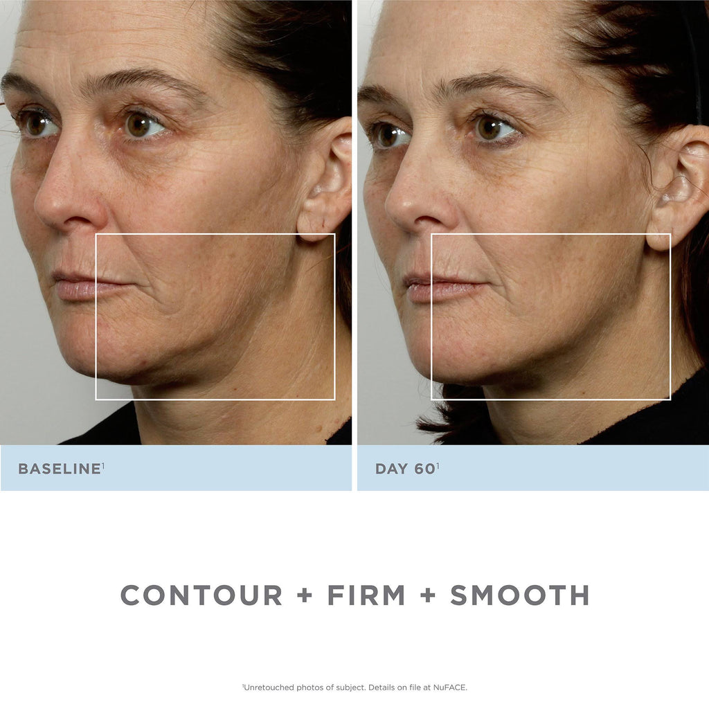 Facial Toning Kit G62088
