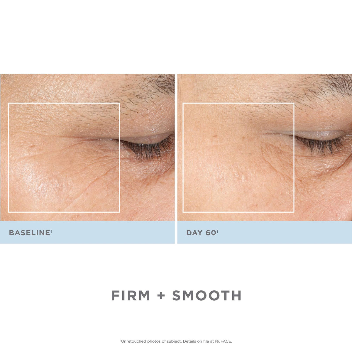 Facial Toning Kit G62088